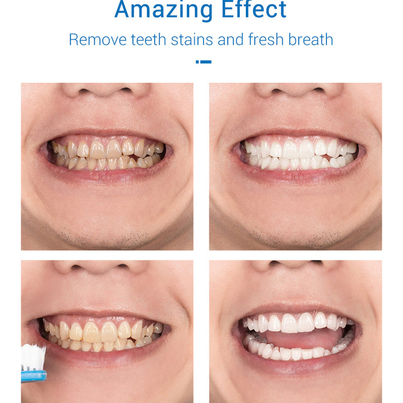 LANBENA Tooth-Cleaning Mousse Toothpaste