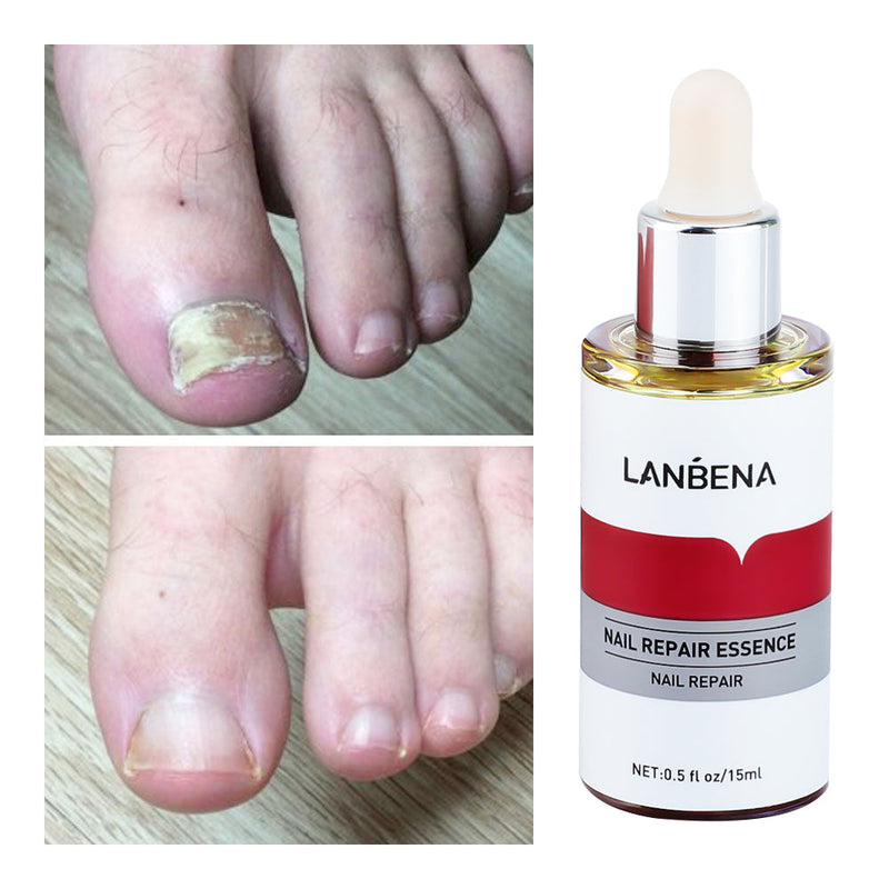 Lambina nail repair essence-1pcs