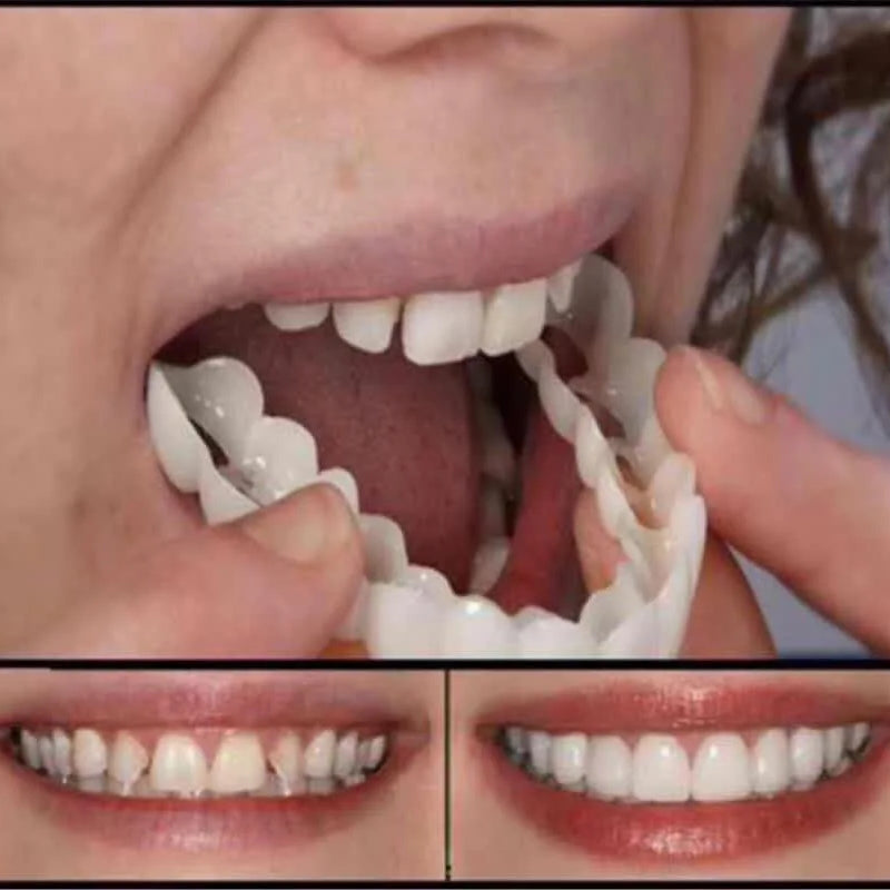 Adult Adjustable Dentures Teeth Set-1 pair