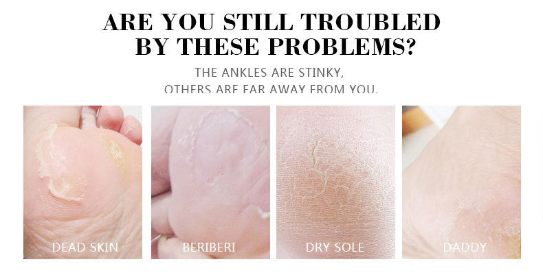 Banana & Milk Extract Foot Cream!