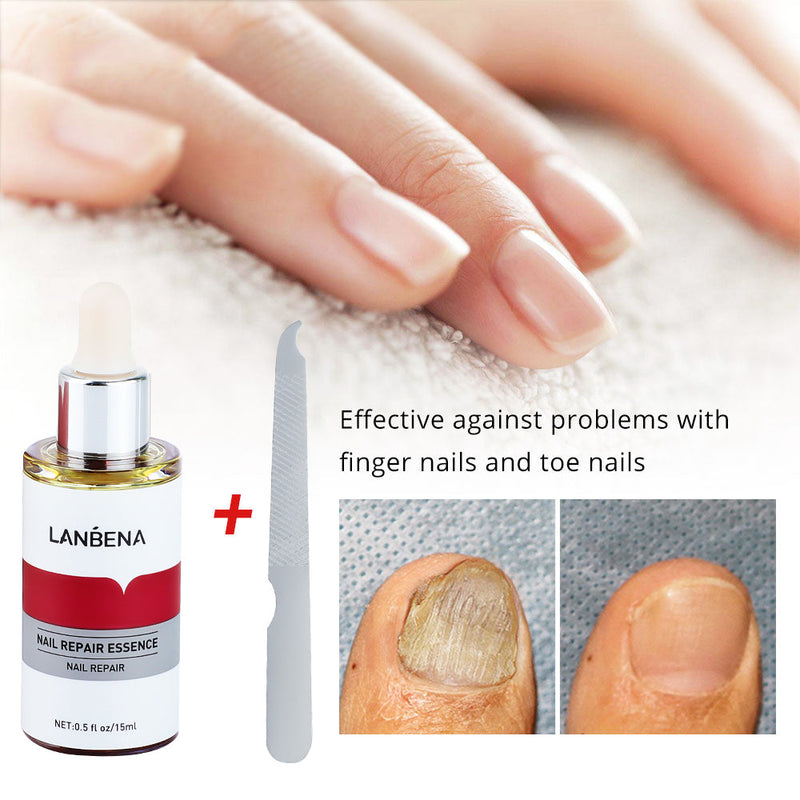 Lambina nail repair essence-1pcs