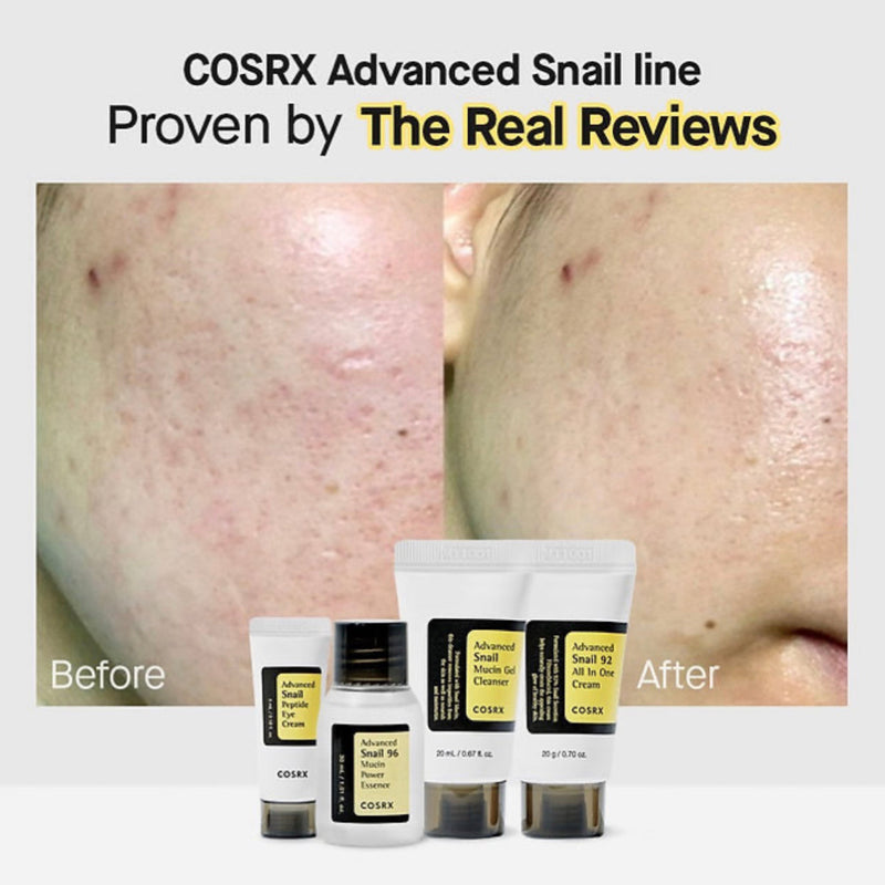 Cosrx All About Snail Kit(Gel Cleanser 20ml,Essence 30ml,Eye Cream 5ml & 92 Cream 20g)