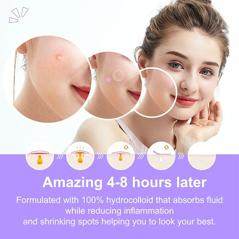 Pimple Patch Acne stickar-120 pcs