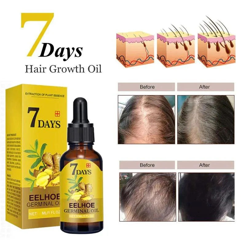 Thailend-Ginger Hair Growth Serum