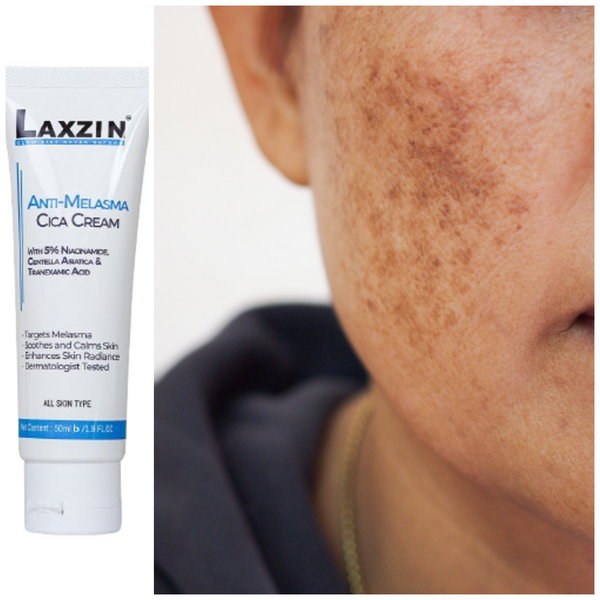 Laxzin Anti-Malasma Cica Cream